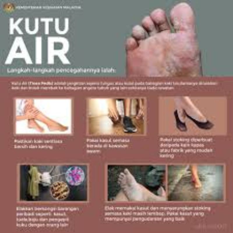 Ubat Kaki Makan Air Kulat Air Shopee Malaysia