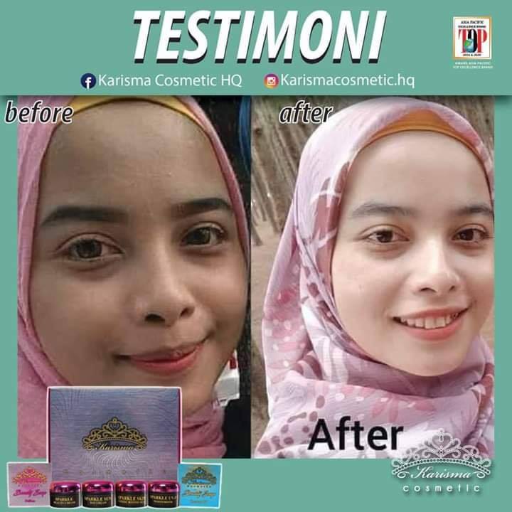 testimoni karisma skincare