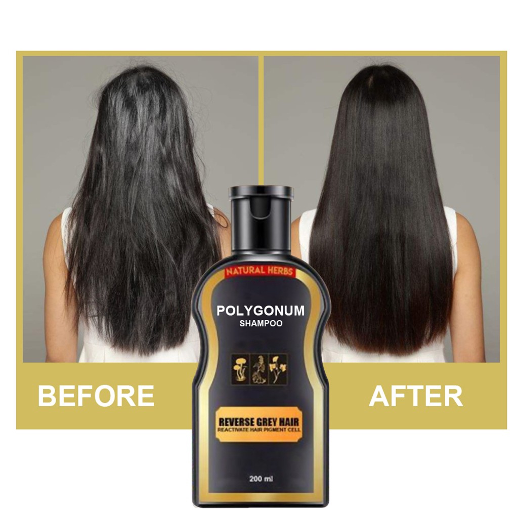 Polygonum Clean Hair Curly Hair Treatment Hair Care Salon Essential Black Hair Shampoo Natural Ginger Coloring Send 1 Bottle At A Time Shopee Malaysia