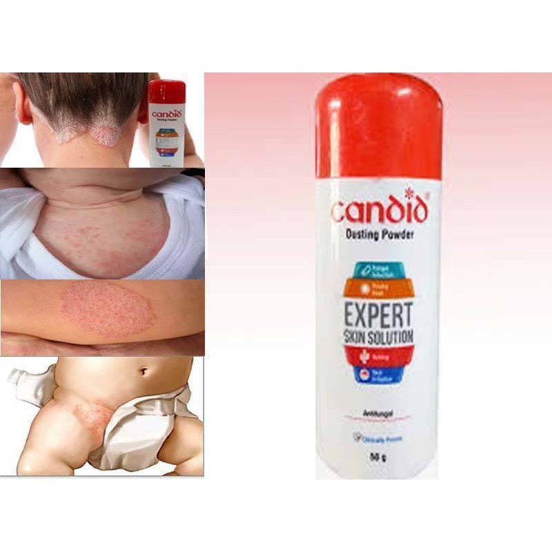 candid powder for diaper rash