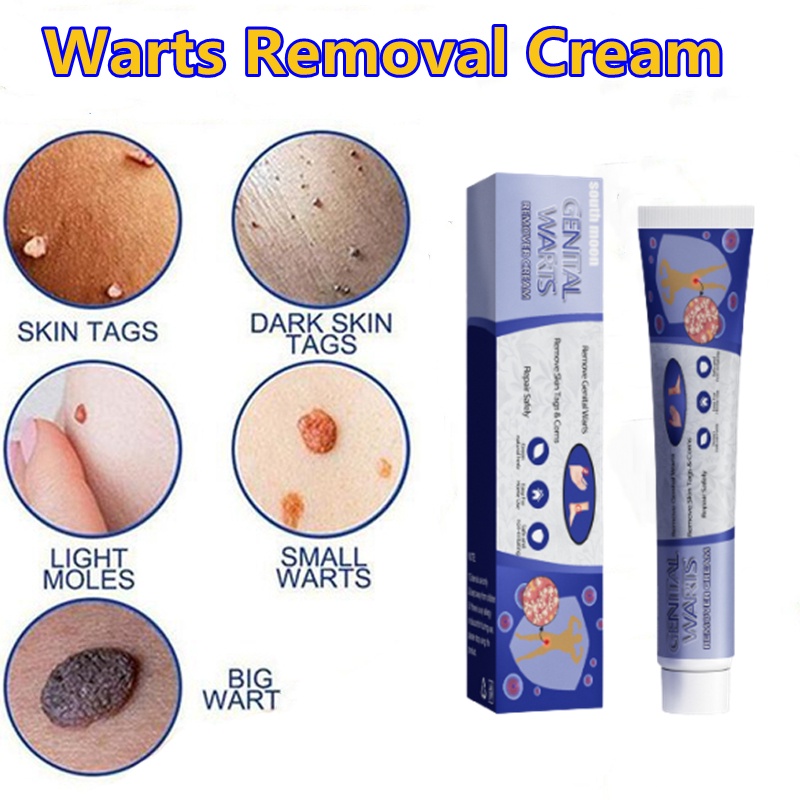 Wart Removal Ointment Fast Remove Skin Tag Remover Original Ointment