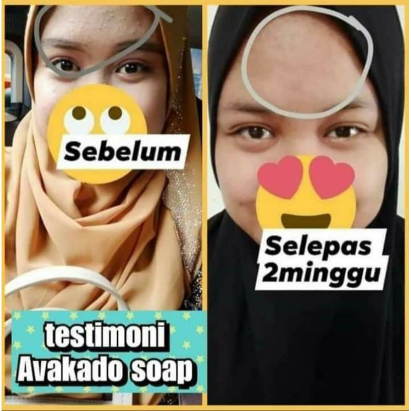 SABUN CUCI MUKA HILANG JERAGAT &JERAWAT AVOCADO FACE & BODY SOAP 💯 ORIGINAL