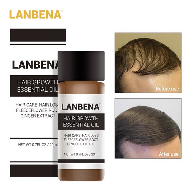 Lanbena 20ml Hair Growth Essence Fast Powerful Hair Care Essential