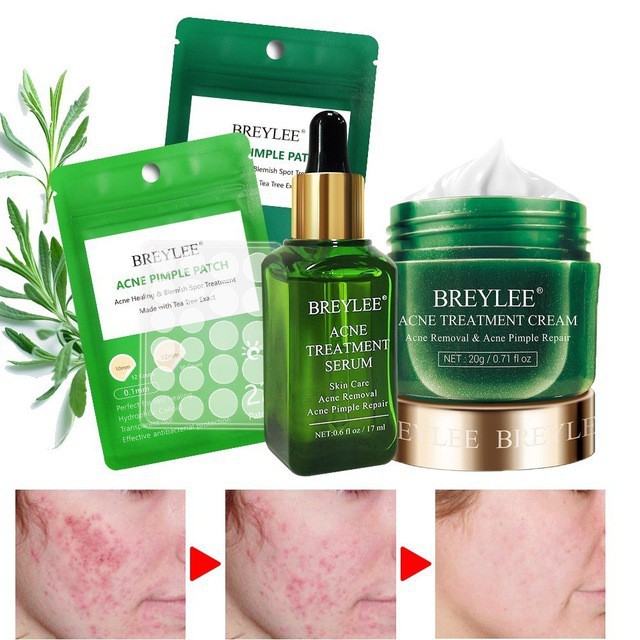 BREYLEE Acne Pimple Patch+Acne Treatment Cream+Acne Treatment Serum Set