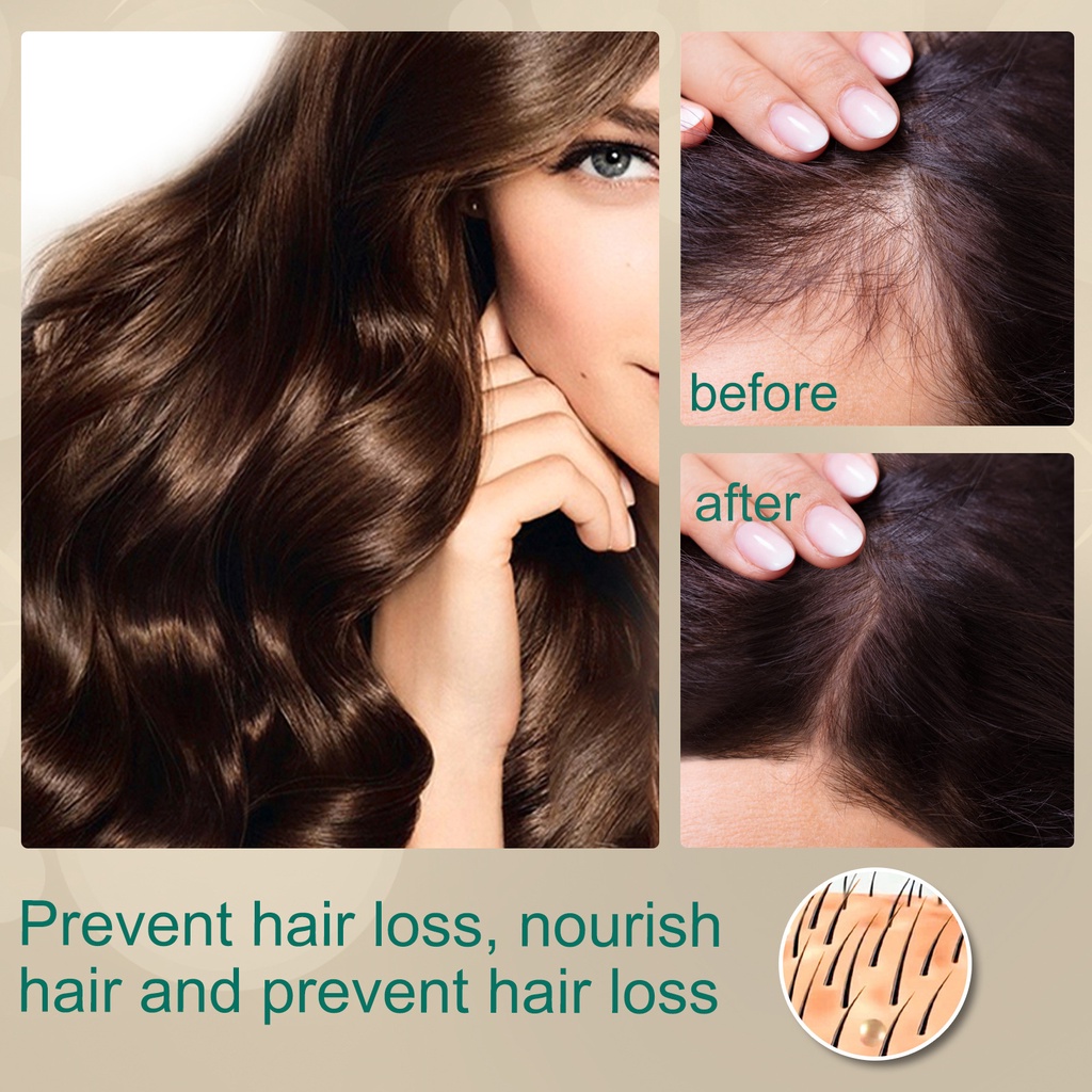 Eelhoe 30g 100g Ginger Day Hair Growth Shengfa Ointment Dandruff Removing  Itching Scalp Massaging Hair Loss Improving Cream Buy Hair Growth Shengfa  Ointment,Hair Loss Improving Cream,Hair Growth Cream Product On | Eelhoe