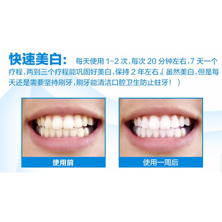 2 Years Warranty Original Megami Led Teeth Whitening Devices Proven In 7 Days Extra Free 2 Gels Shopee Malaysia