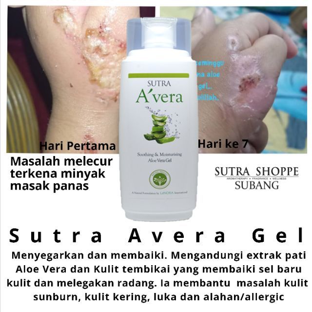 Sutra Avera Gel Aloe Vera Burn Wound Sunburn Alahan Acne Moisturizer Kulit Kering Ekzema Baby Lecur Scar Shopee Malaysia