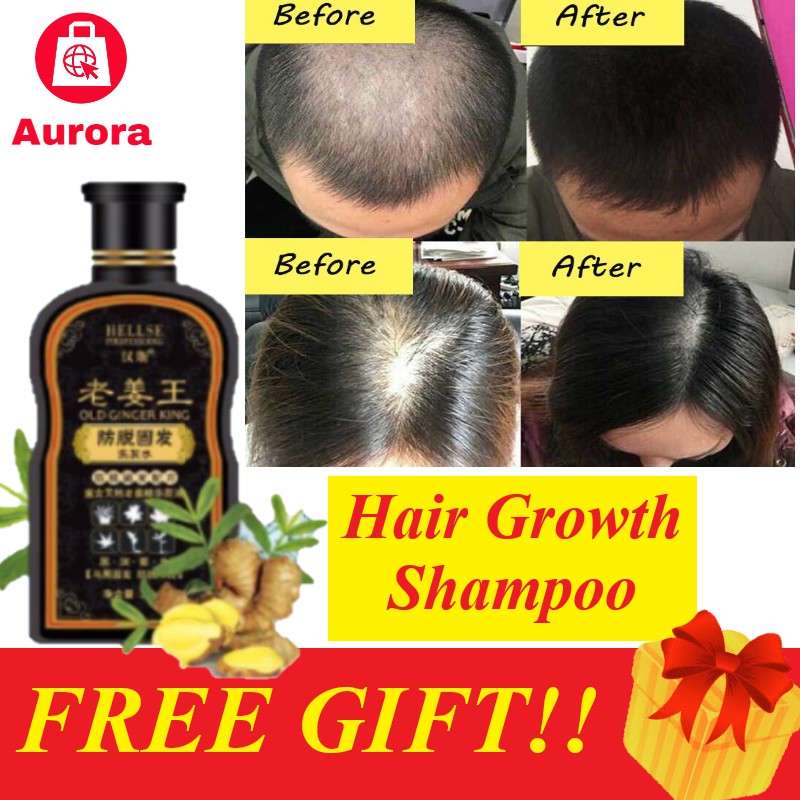 Ginger Juice Hair Growth Shampoo Anti Dandruff Solid Hair Cont