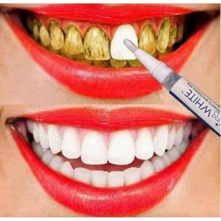 Teeth Whitening pen Dazzling white, Putih gigi dengan cepat dan berkesan, bersihkan plak gigi, karat, kerak and other .