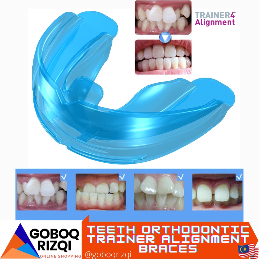Teeth Orthodontic Appliance Alignment Tooth Retainer Bruxism Mouth