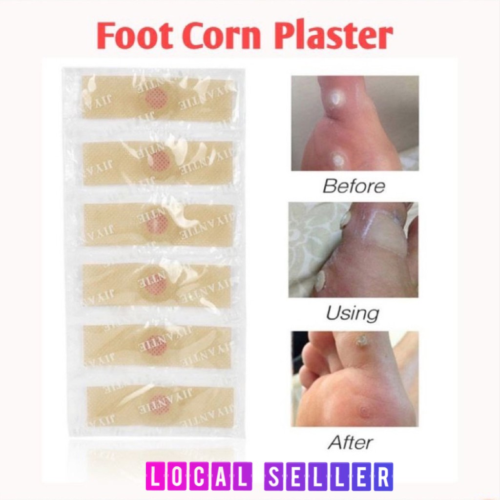 foot corn removal plaster