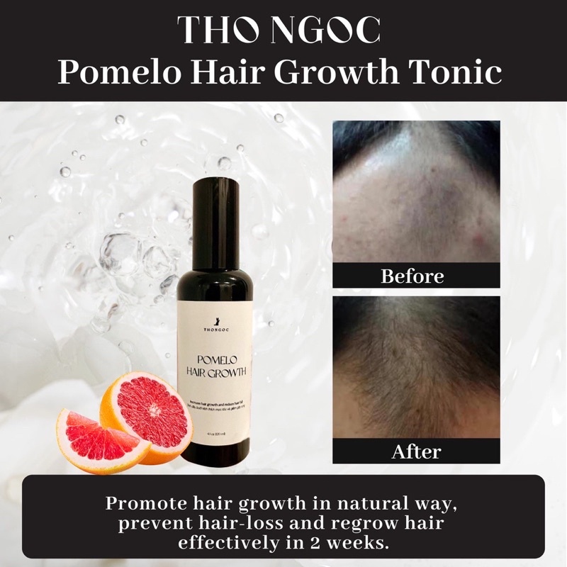 [GROW HAIR IN 14 DAYS!!!] THO NGOC Pomelo Hair Growth Tonic 100