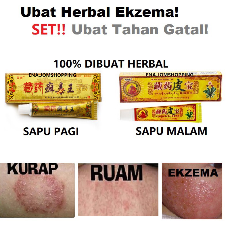 Ubat Gatal Herba Mujarab Ubat Kurap Ubat Ekzema Eczema Sensitive Kulit è—è¯çš®å® Shopee Malaysia
