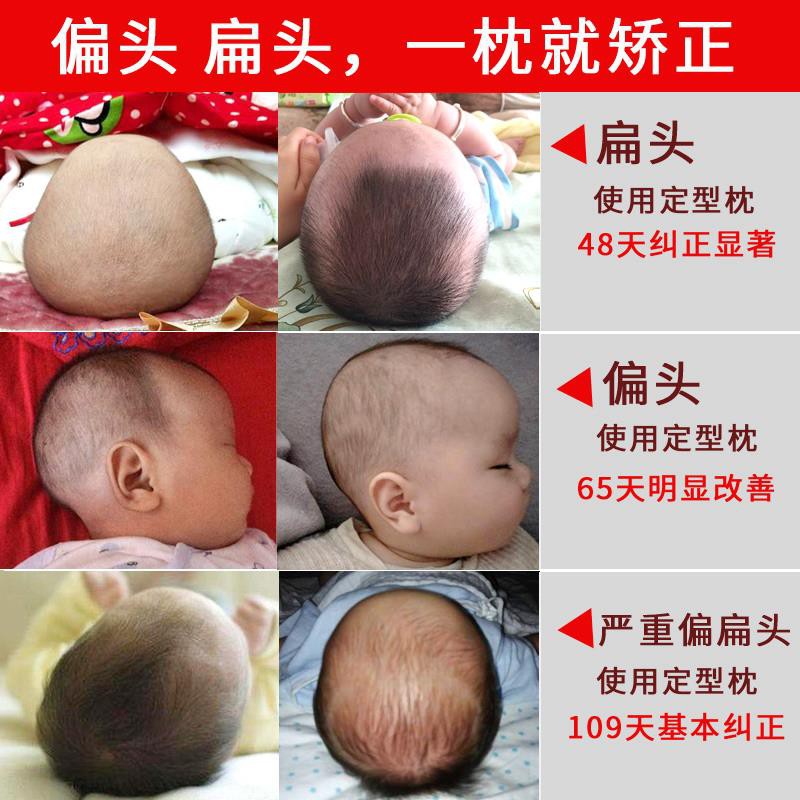 Baby Pillow Shaping Pillow Baby Correction Correction Anti Eccentric Head Flat Head Memory Pillow Ne婴儿枕头定型枕宝宝纠正矫正防偏头扁头记忆枕头新生儿童透气四季