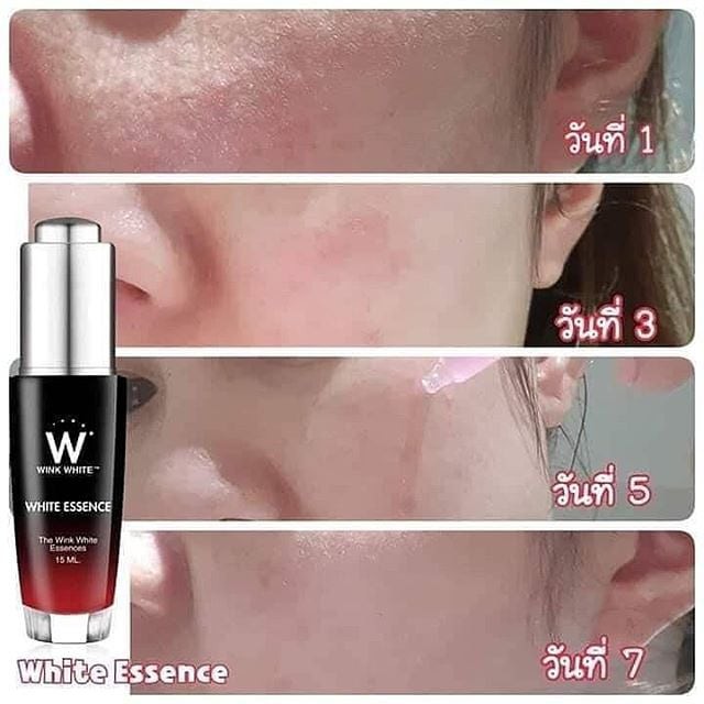 Wink White Essence 15ml Shopee Malaysia