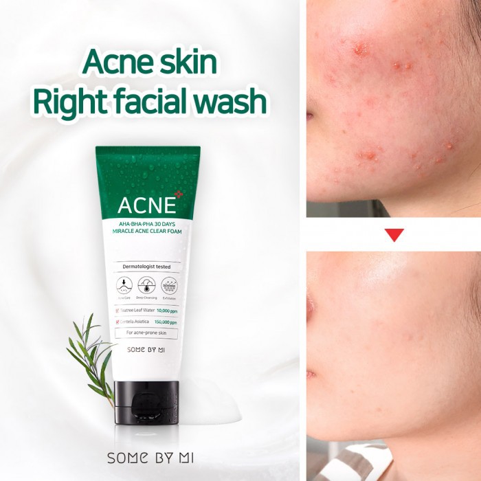 aha bha pha 30days miracle acne clear foam