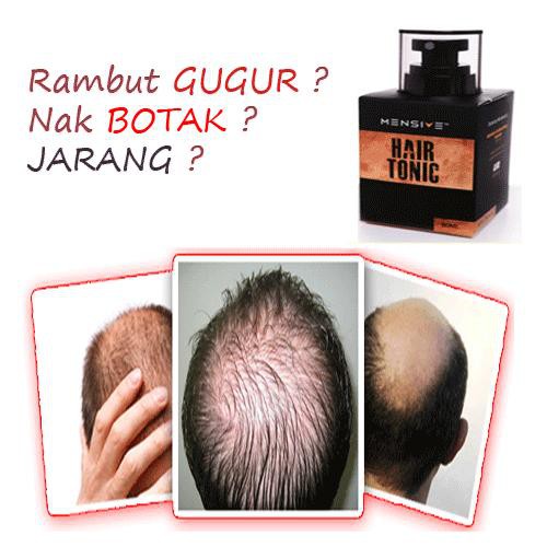 Hair Tonic Mensive Untuk Rambut Jarang Gugur Dan Botak Shopee Malaysia