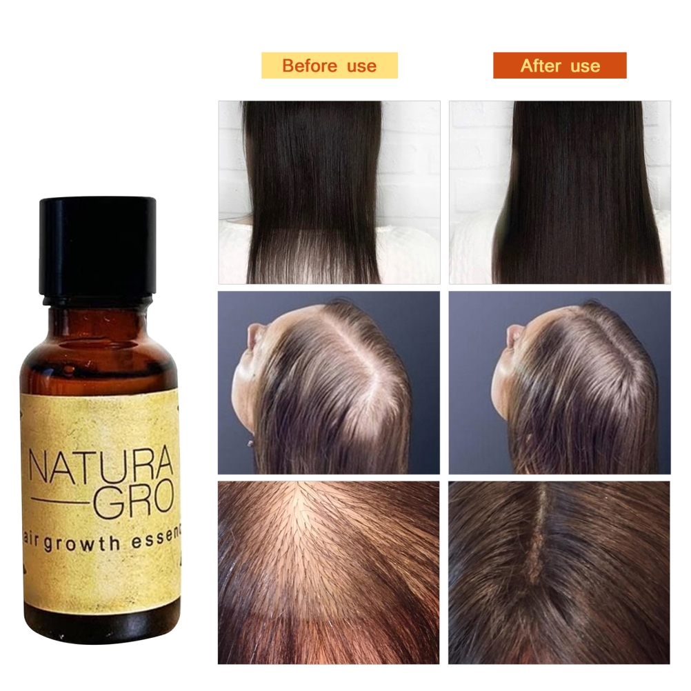 20G Hair Growth Serum Hair Growth Essential Oil Anti Detachment Repair  Scalp Hair Care Solution | Shopee Malaysia