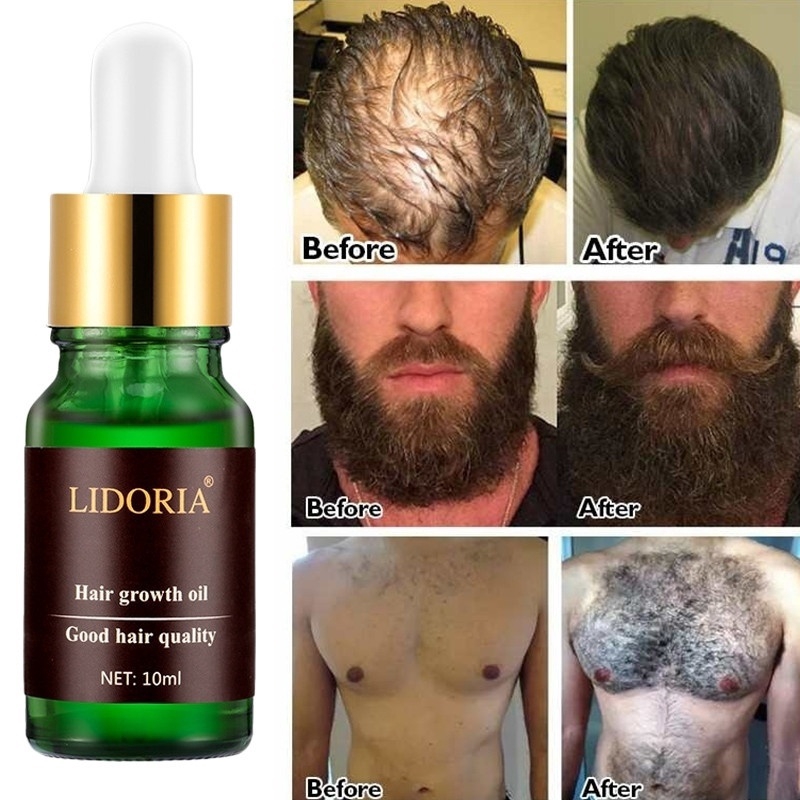 Hair Loss Products Natural With No Side Effects Grow Hair Faster