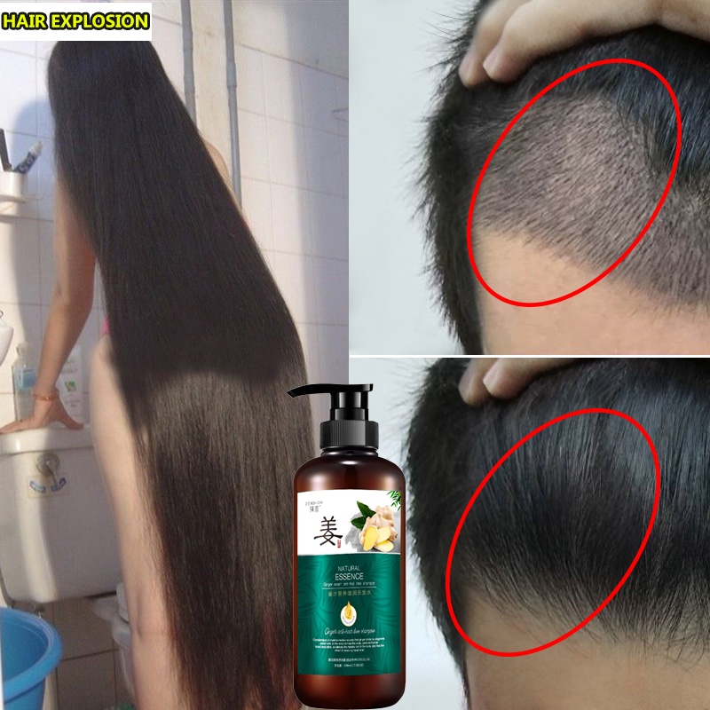 Local stock】Ginger shampoo regeneration shampoo hair loss treatment shampoo promote  hair growth thick hair | Shopee Malaysia