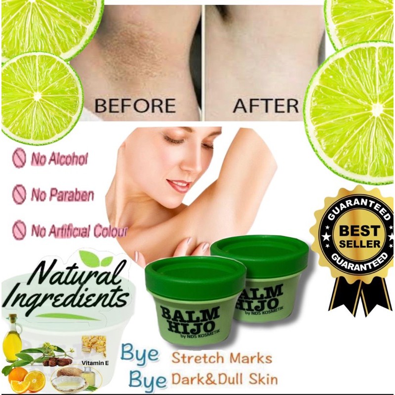 Balm Hijo Krim Hilangkan Pelipat Pink Nipple Cerahkan Celah Peha Shopee Malaysia