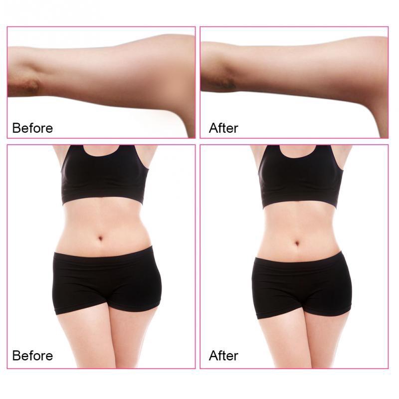 R F Multipolar Blasting Fat Instrument Body Slimming Skin Lifting Machine Shopee Malaysia - faded muscle abs roblox