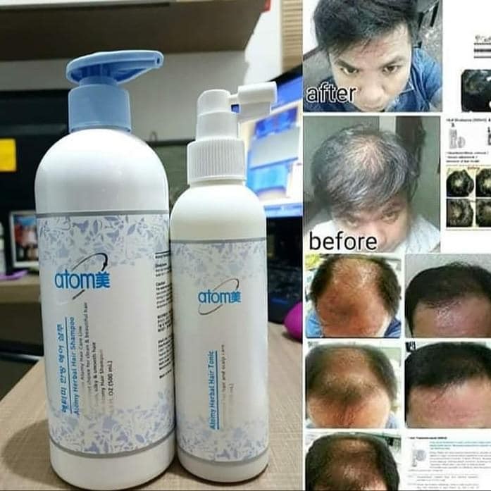 ATOMY Hair Growth/ Hair Loss Treatment Set of Herbal Hair Shampoo 500ml