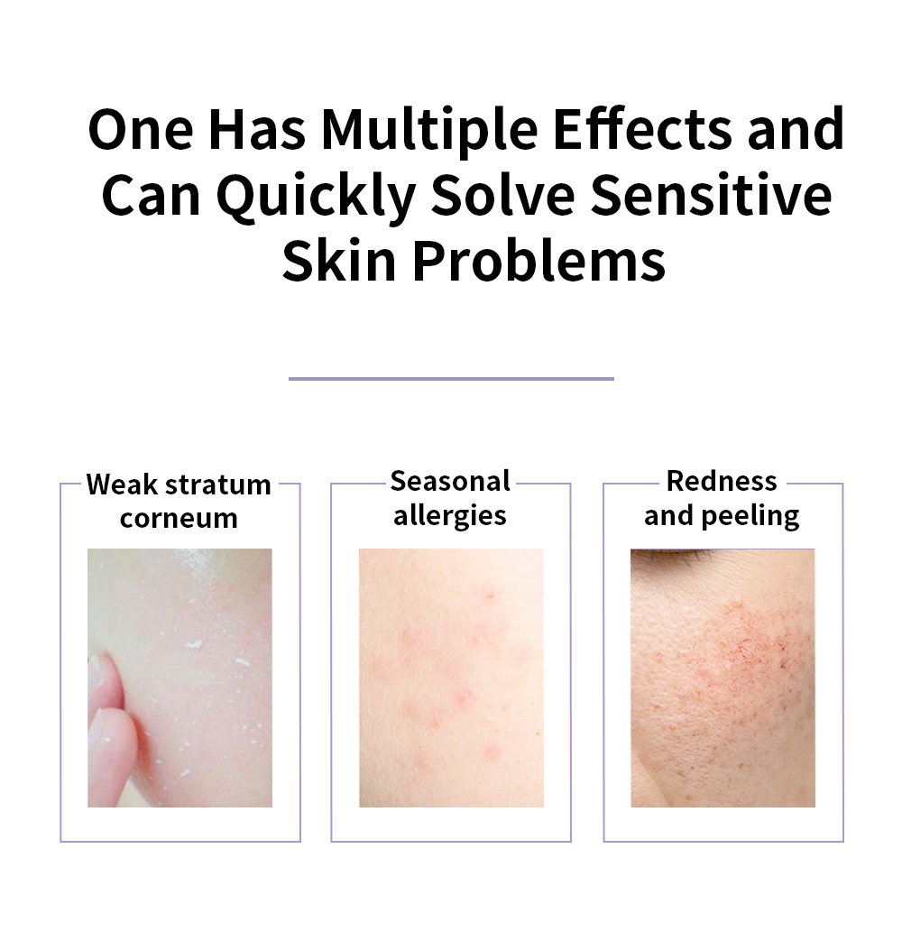 LANBENA Soothing Face Moisturizer Repair Cream Relieves Redness