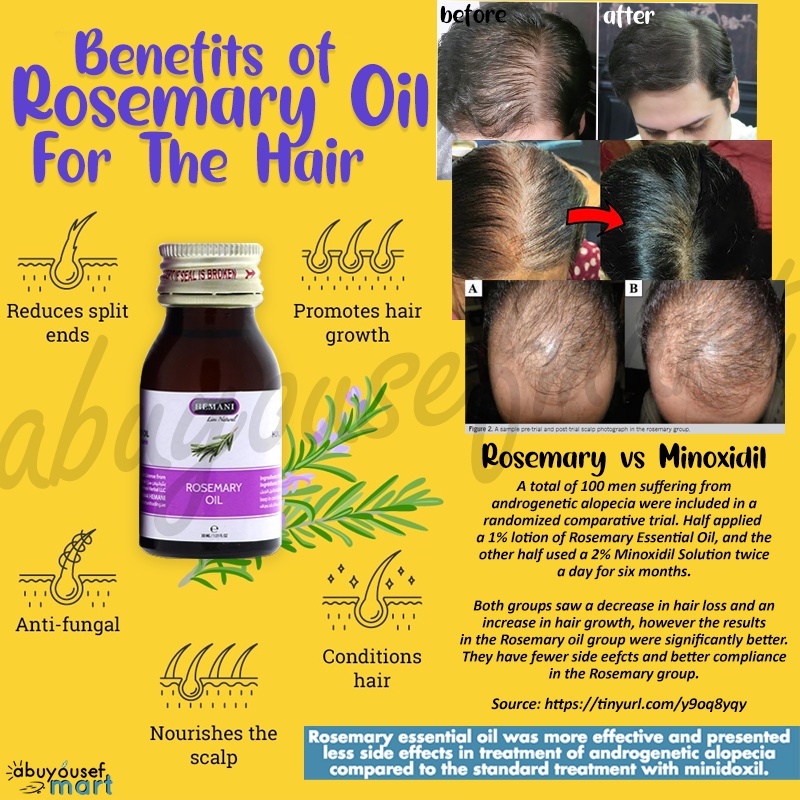 Hemani Rosemary Oil | Minyak Rosmeri 30ml - Rawat Rambut Gugur, Lebat  Rambut Bayi | For Hair Growth & Prevent Hair Loss | Shopee Malaysia