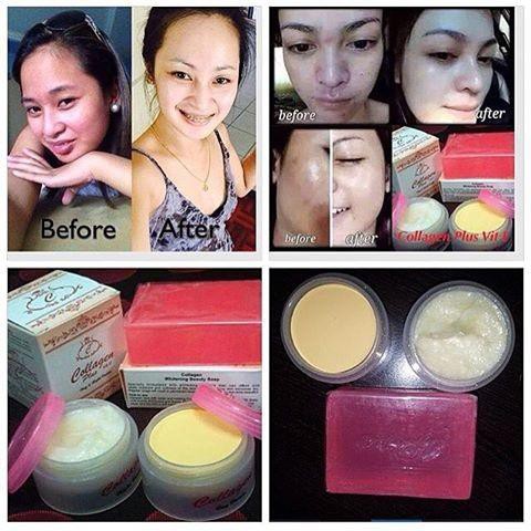 Original Vit E Collagen Plus Set Whitening Beauty Shopee Malaysia