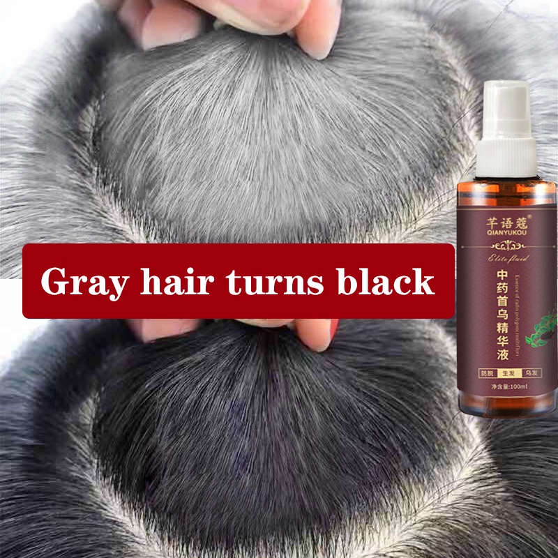 Black Hair Spray White Hair Turn Black Polygonum Multiflorum Essence Anti White  Hair Scalp Treatment Anti Hair Lost Shopee Malaysia | Polygonum Multiflorum  Hair Growth Spray Nutrient Essence Moisturizing Hair Roots |