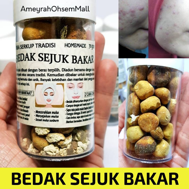 Bedak Sejuk Aloevera 45g Kecut Jerawat Putihkn Wajah Big Ball Powder Malaysia