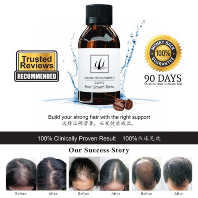 Nano Hair Growth Clinic Shampoo + Tonic Set | Shopee Malaysia