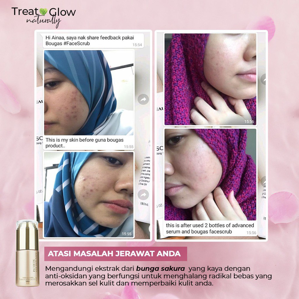 Buy Free Gifts Bougas Beauty Advanced Serum For Acne Free And Glowing Skin Seetracker Malaysia