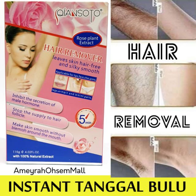 Krim Tanggal Sgala Bulu Bulu Kt Miss V Bulu Ketiak Dan Bulu Kt Muka Shopee Malaysia
