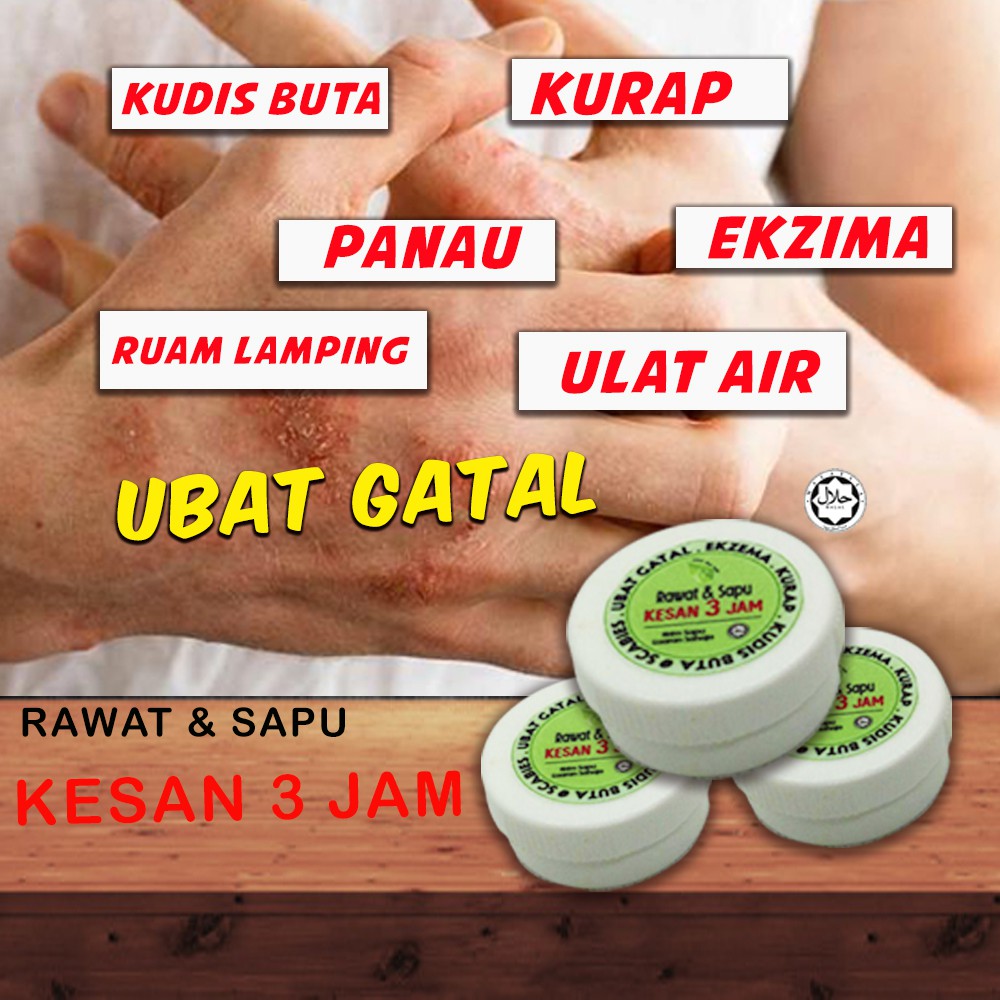 Ubat Gatal Kudis Kurap Panau Makan Air Gatal Celah Kangkang Shopee Malaysia