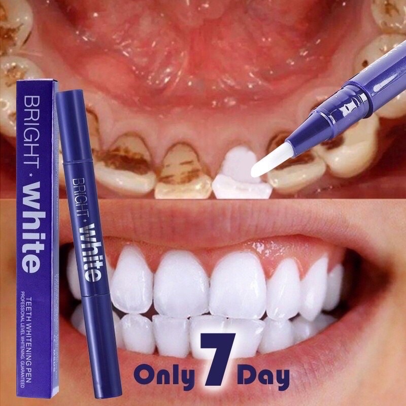 Pen Pemutih Gigi Teeth Whitening Pen Putihkan Gigi Dengan Cepat Dan