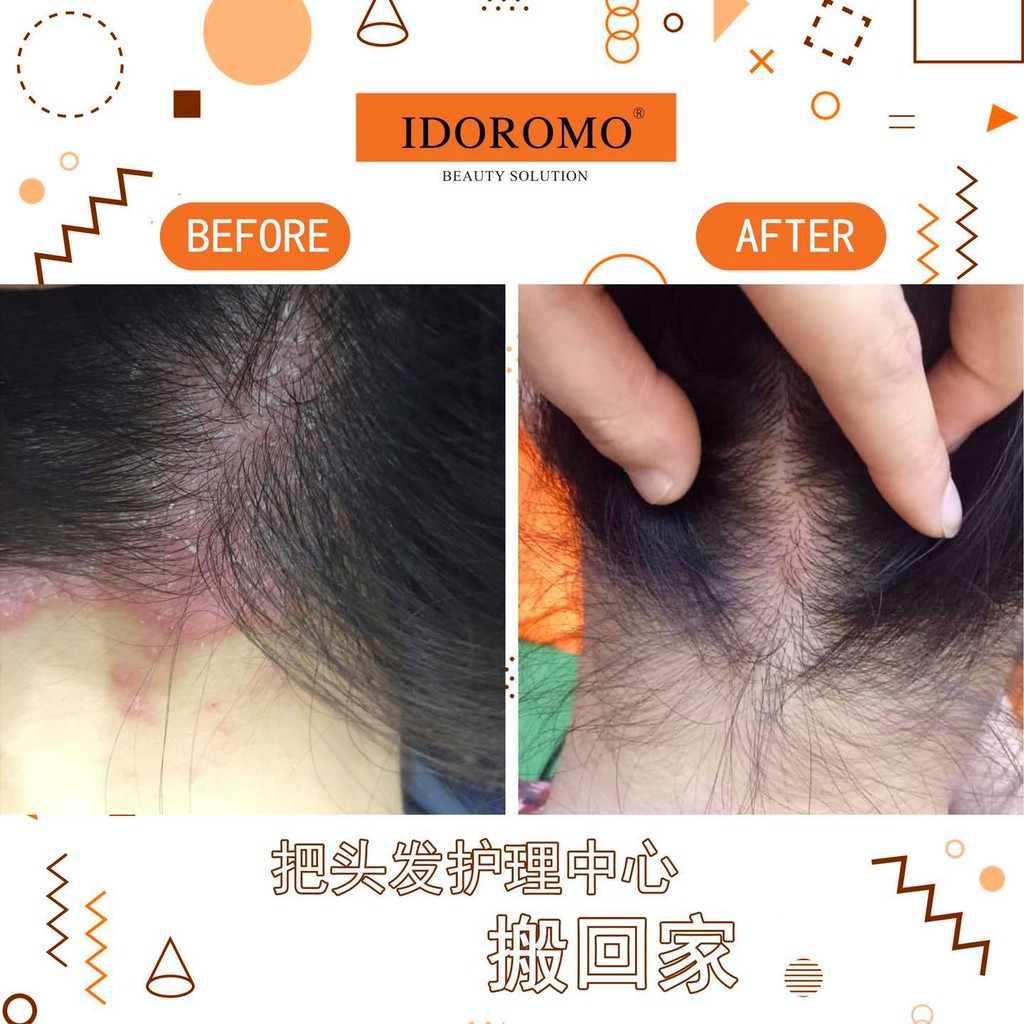 IDOROMO Hair Growth Nourishing Liquid Vitamin | Shopee Malaysia