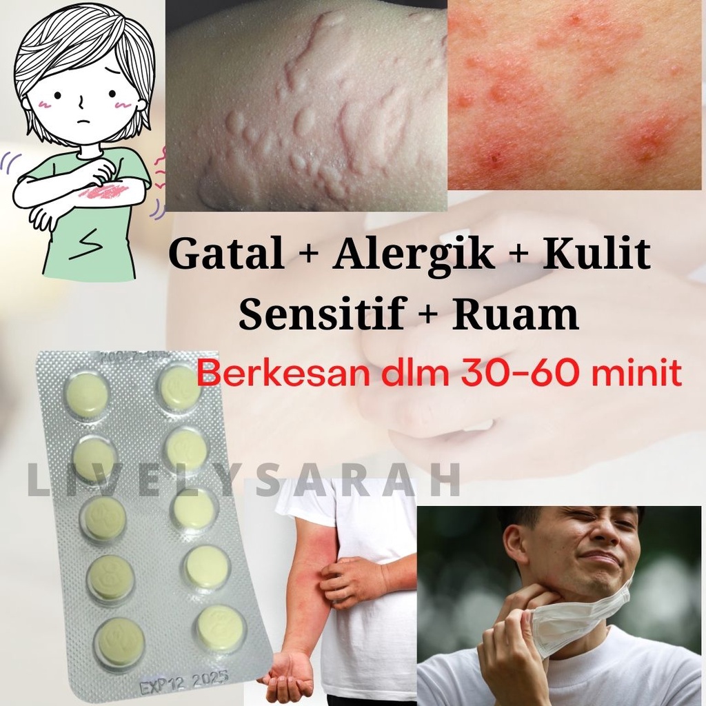 Alergik gatal ubat Alergik gatal