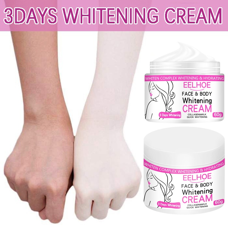 Elbow Knee Thigh Skin Whitening Dark Skin Lightening Bleaching Cream