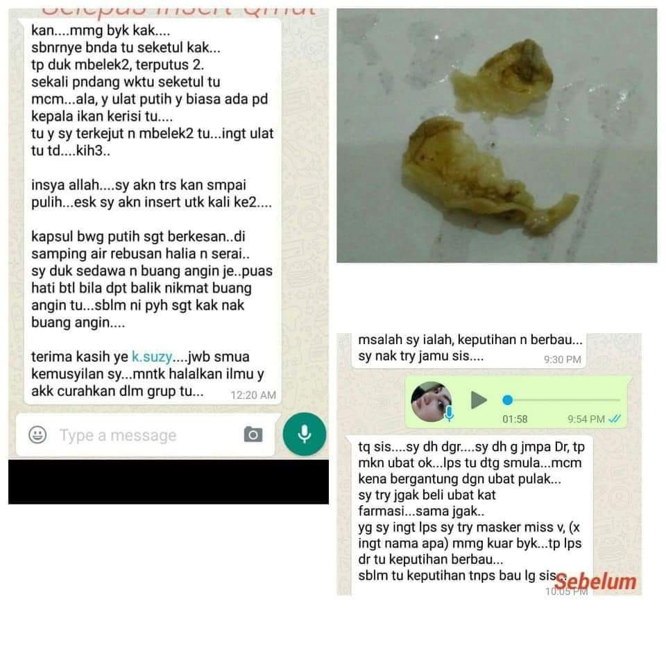 Rapatkan Faraj Hot Item Ready Stock Insert Qmut Maajun Rapat Ketat Keputihan Masaalah Becak Hilangkan Bau Shopee Malaysia