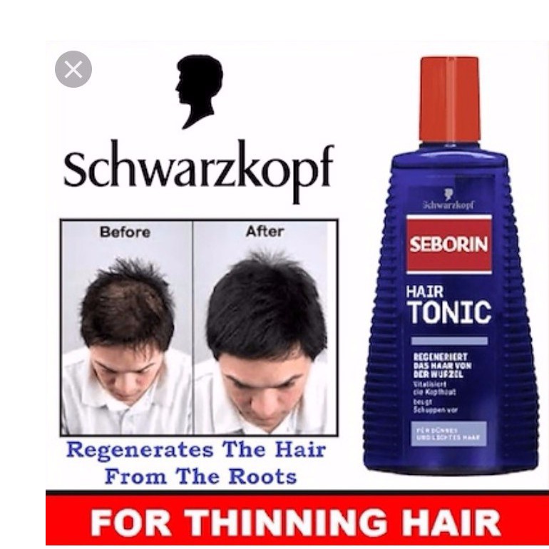 Tonik Rambut Rawatan Rambut Gugur Suburkan Tebalkan Rambut Nipis Formula Paling Berkesan Stok Tersedia Shopee Malaysia