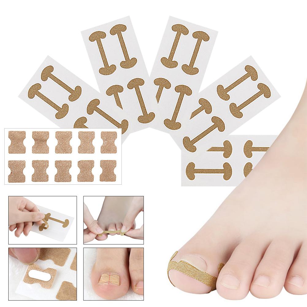 10pcs Toenail Correction Patch Glue Free Pedicure Tools Toe Nail ...