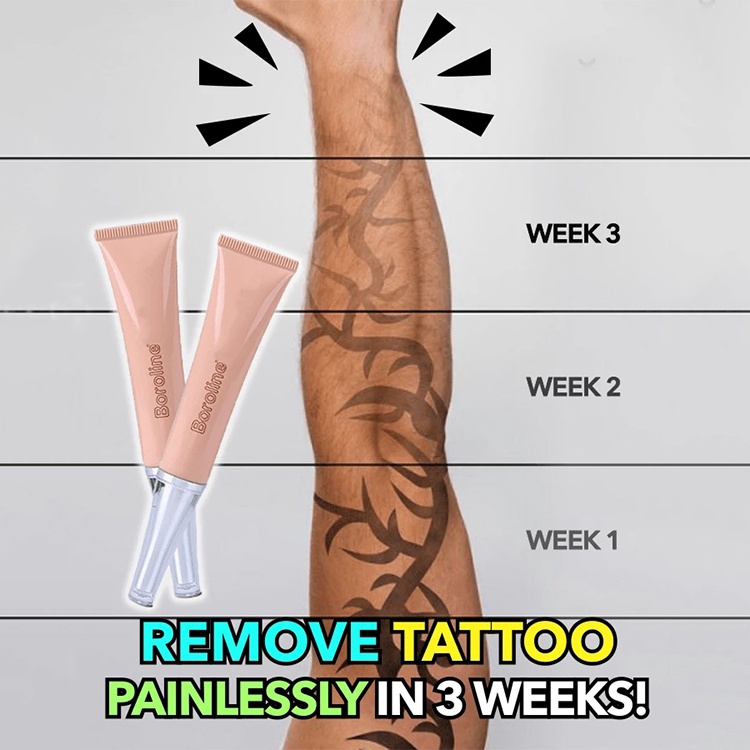 Permanent Tattoo Removal Cream Remove Painlessly In 3 Weeks Shopee Malaysia