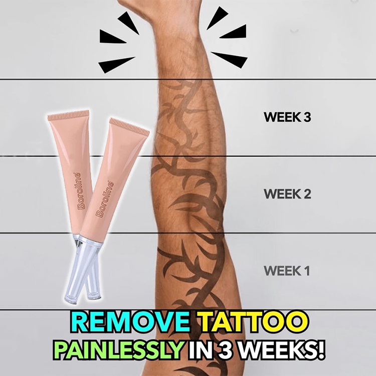 Tattoo Removal Cream Permanent Of Tattoos Iglamdigital Com Ar   F616426d41fb567527e5d5079b35797b