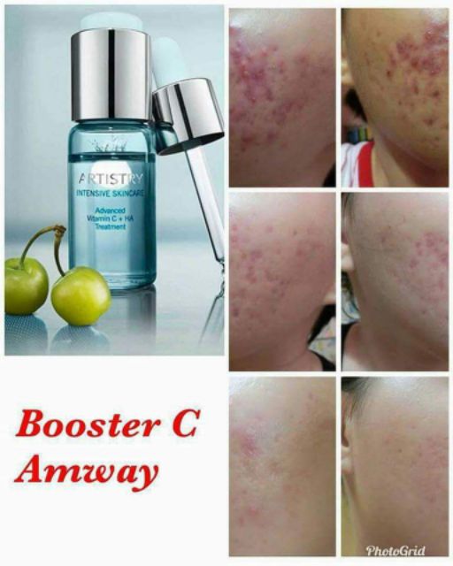 artistry vit c serum