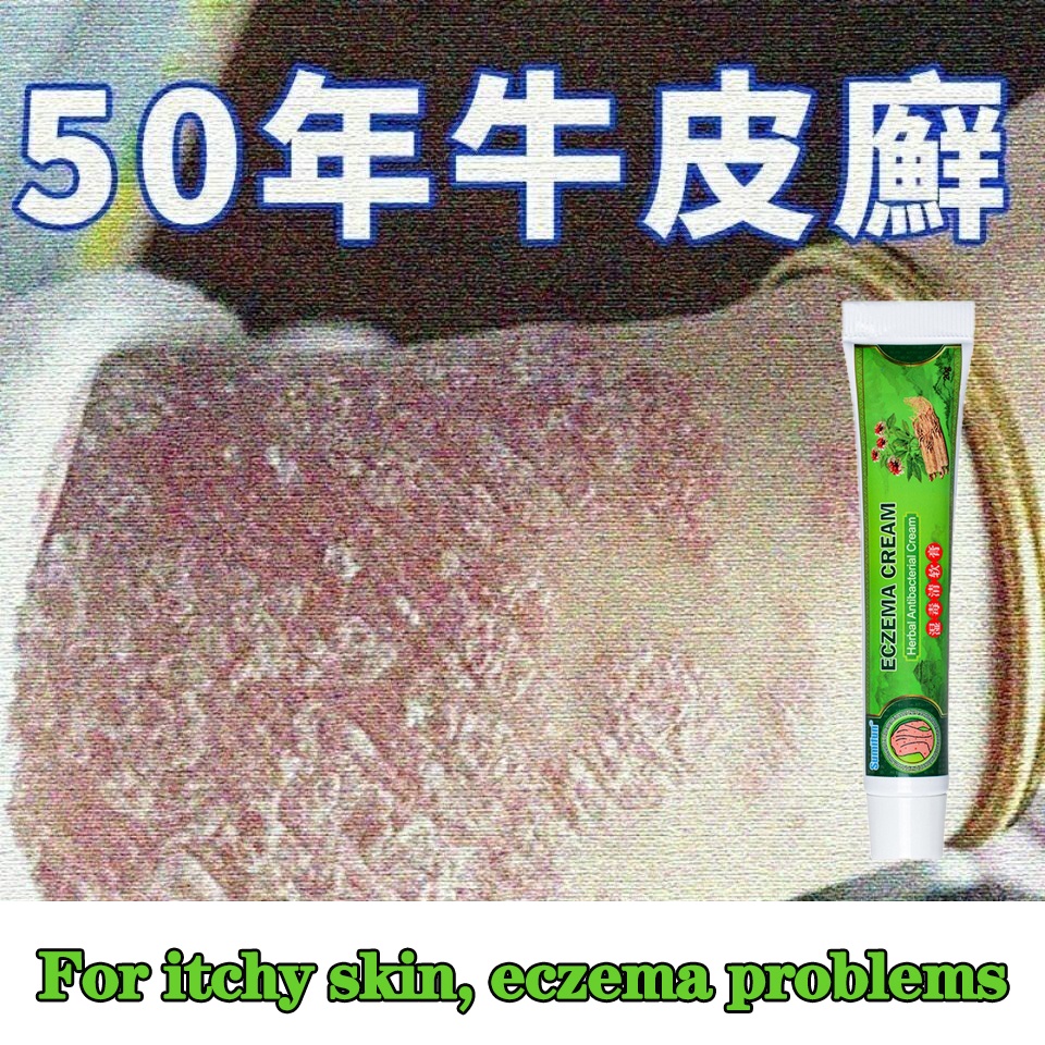 Eczema Antibacterial Psoriasis Ointment Treatment Anti Itch Ubat Gatal Cina Krim Gatal Kulit Fungisol Antifungal æ¿ç¹æ­¢ç¢è Shopee Malaysia
