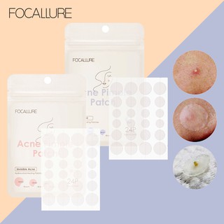 Focallure Acne Pimple Patch Spot Patch Acne Treatment Blemish Skin
