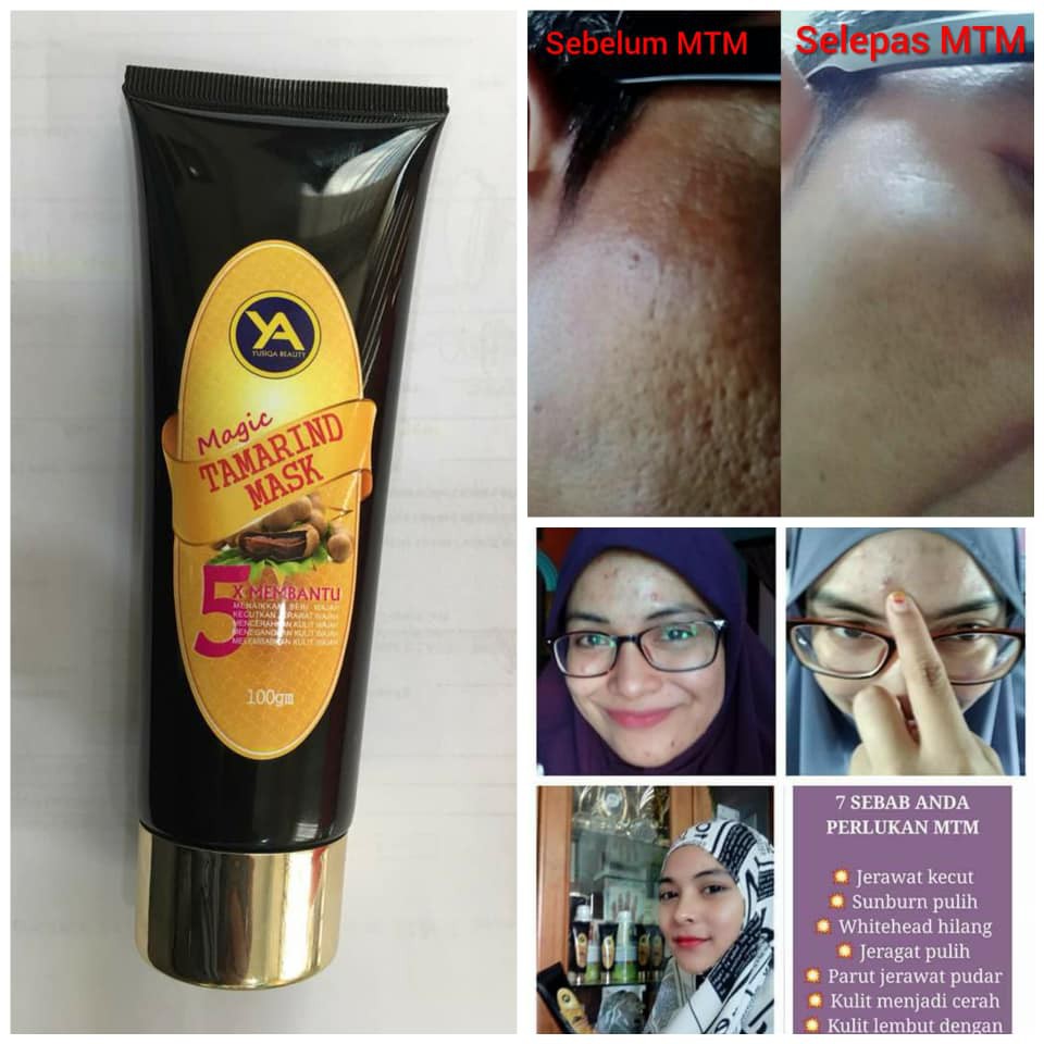 Magic Tamarind Mask Merawat Kulit Wajah Masker Mask Face Whitehead Muka Remover Glow Men Women Parut Jerawat Qbgr Shopee Malaysia