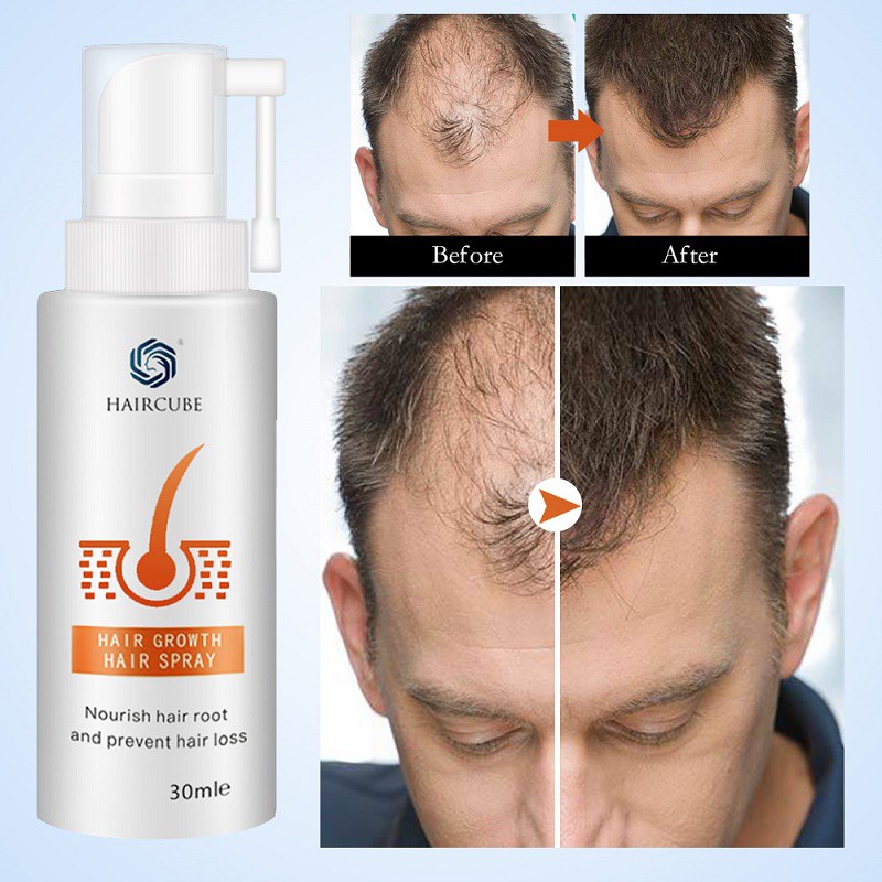 Spot Free Shipping]HAIRCUBE Stop Anti Hair Loss Fast Hair Growth Products  For Men Woman Hair Growth Spray Essential Oil | Shopee Malaysia